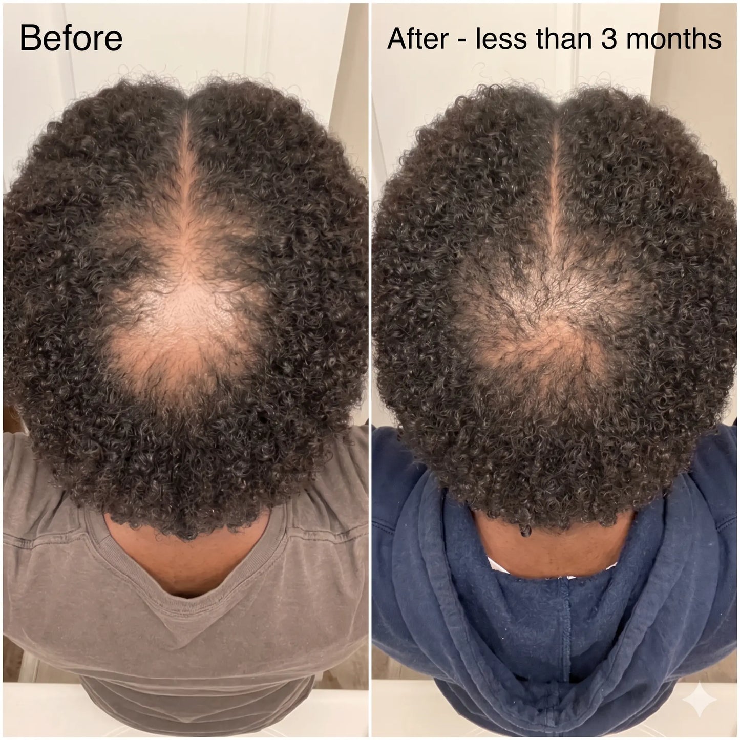 Samson Revive™ - Reclaim Your Crown (1.69 fl. oz)